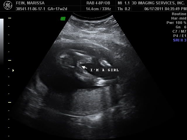 3d ultrasound 20 weeks boy. for a 3d ultrasound around